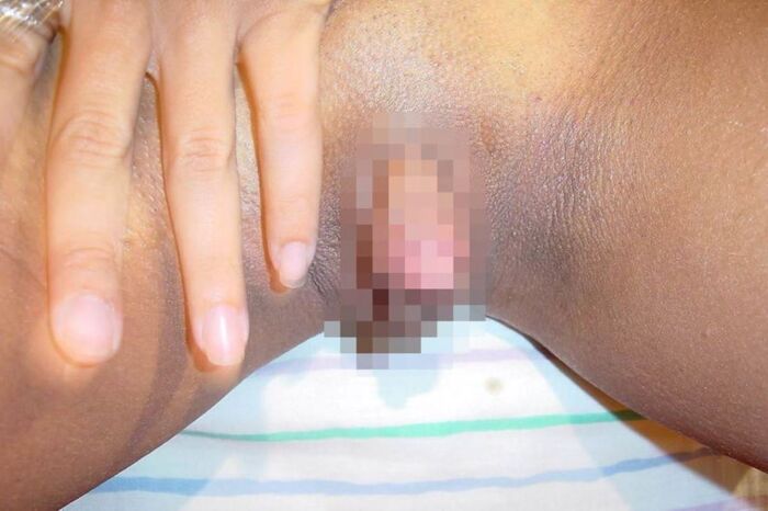 Clitoris!! Too huge erection clitoris image 14th image