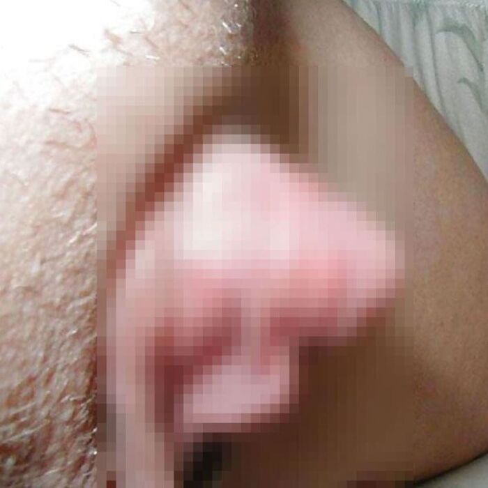 Clitoris!! Too huge erection clitoris image 19th image
