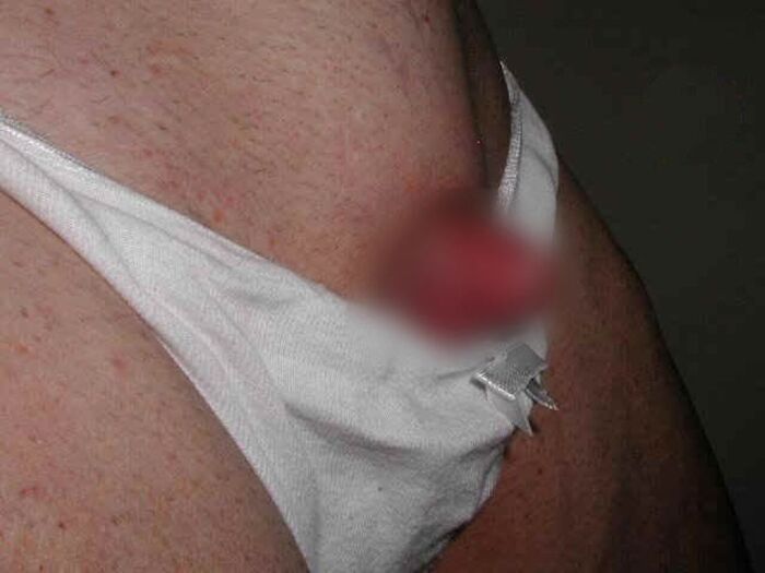Clitoris!! Too huge erection clitoris image 25th image