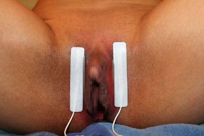 Clitoris!! Too huge erection clitoris image 26th image