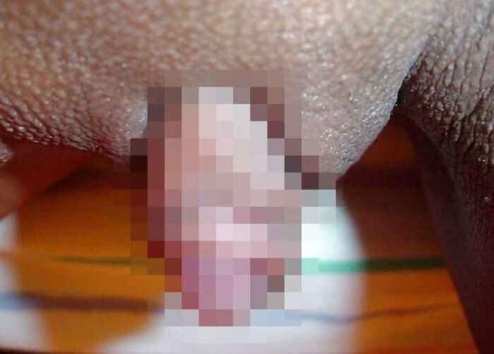 Clitoris!! Too huge erection clitoris image 28th image