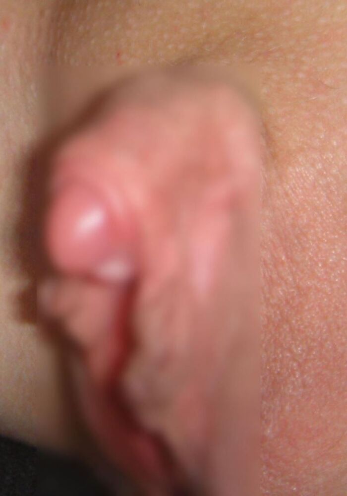 Clitoris!! Too huge erection clitoris image 3th image