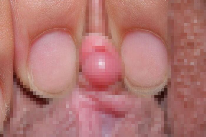 Clitoris!! Too huge erection clitoris image 33th image