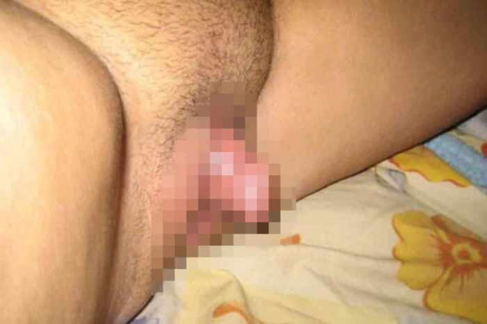 Clitoris!! Too huge erection clitoris image 35th image