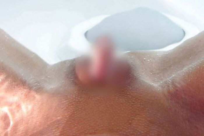 Clitoris!! Too huge erection clitoris image 36th image