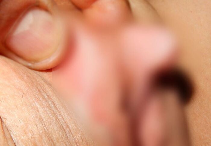 Clitoris!! Too huge erection clitoris image 37th image