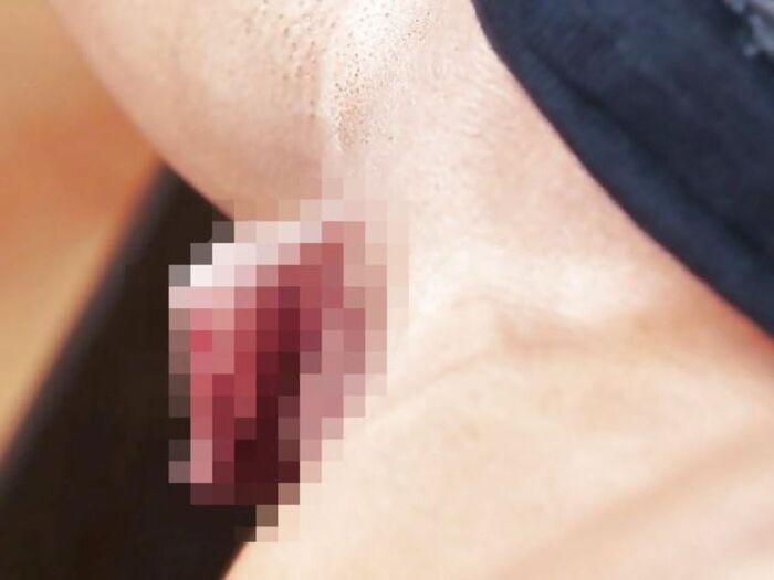 Clitoris!! Too huge erection clitoris image 45th image