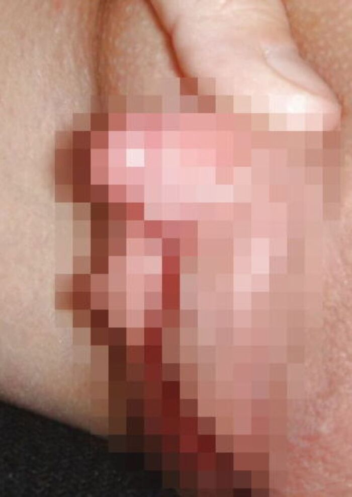 Clitoris!! Too huge erection clitoris image 50th image