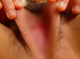 image collection peeling labia majora and labia minora