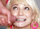 Oral fetish erotic image of a foreigner wearing braces