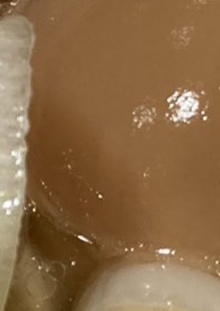 【Image】Quiz to guess whether it is the butt of a black gal or a boiled egg of ramen 9th image